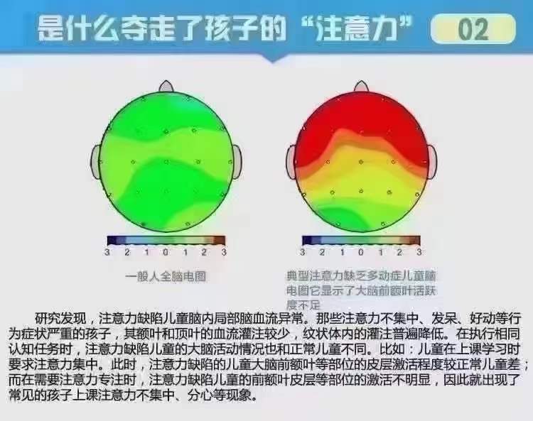 专注力不足的体现：